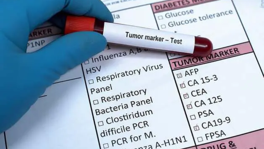 Xét nghiệm máu cho chỉ số ung thư tăng cao nên làm gì?